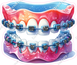 Dental - Braces