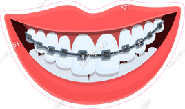 Dental - Mouth with Braces w/ Variants
