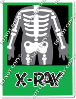 X - Ray w/ Variants